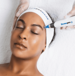 Microneedling adelaide