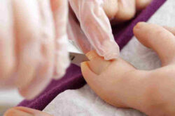 Podiatrist Canberra